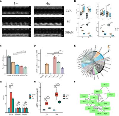 IL6/adiponectin/HMGB1 feedback loop mediates adipocyte and macrophage crosstalk and M2 polarization after myocardial infarction